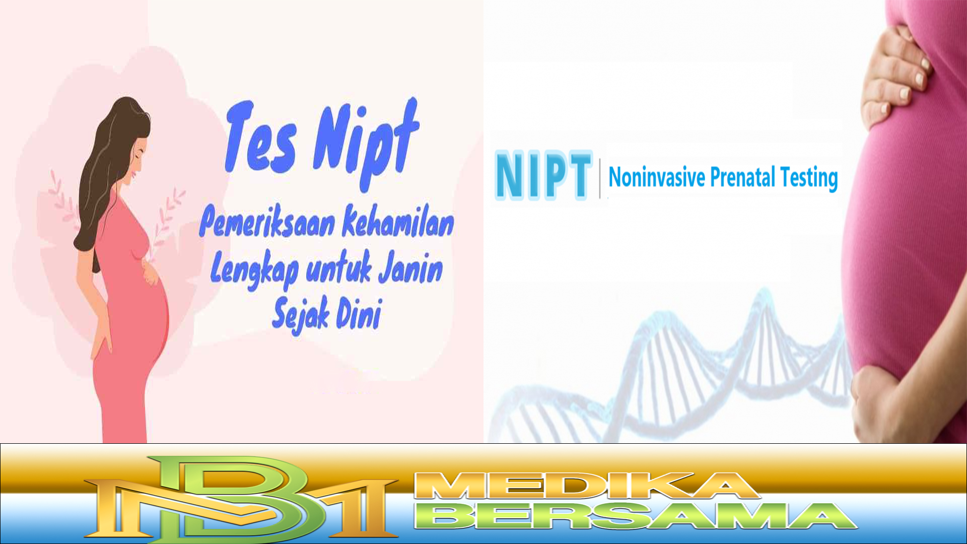 NIPT, Skrining Kelainan Bawaan pada Janin