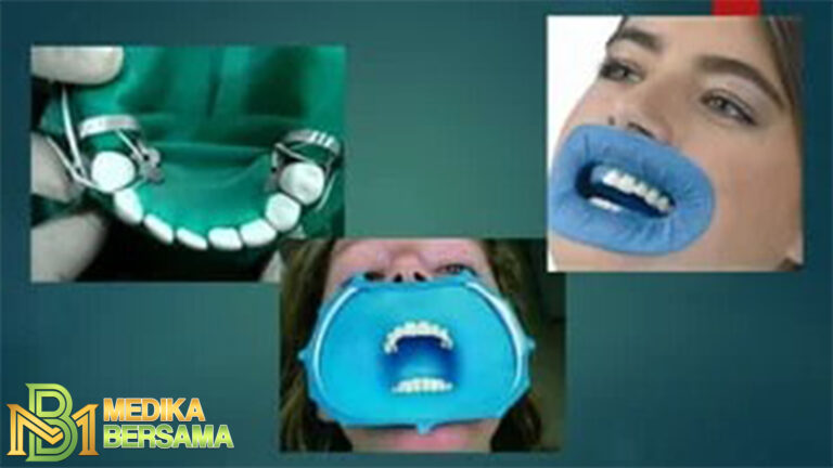 Mengenal Dental Dam: Pelindung Saat Seks Oral
